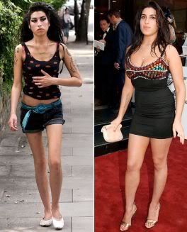 Edad corporal de Amy Winehouse