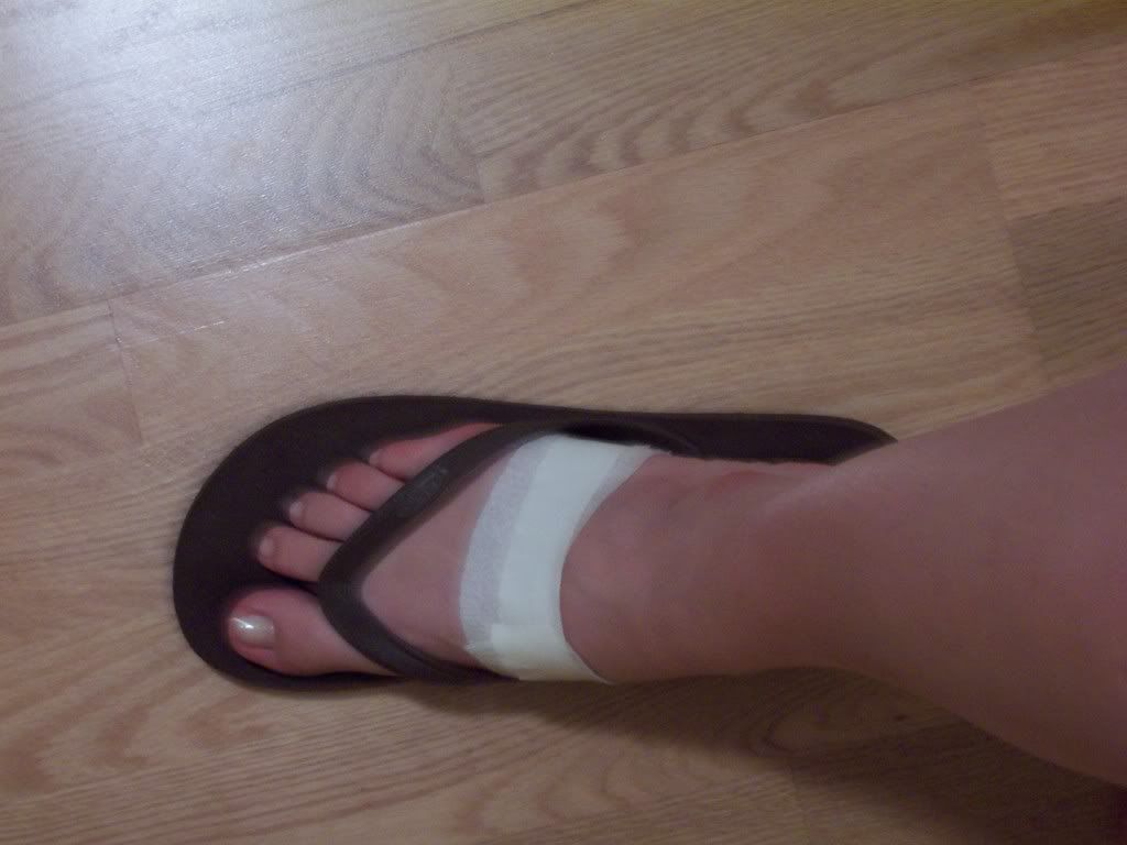 My Cut Up Foot From Promstupid People Who Leave Glass On The Ground